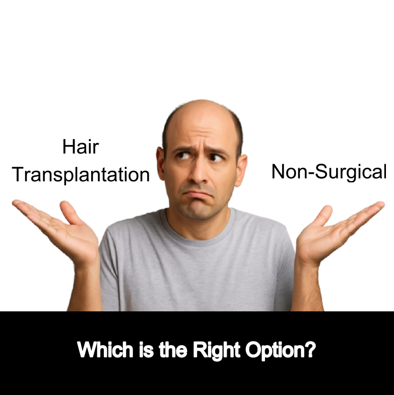 Hair Restoration: Surgical vs. Non-Surgical Hair Replacement Options